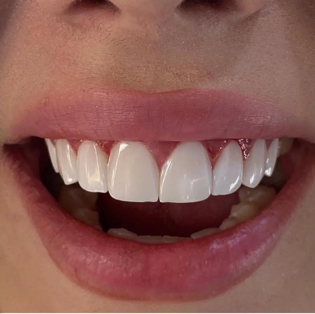 دندانپزشکی و دندان سازی خیریه چمران (جراحی. زیبایی - تصویر 5