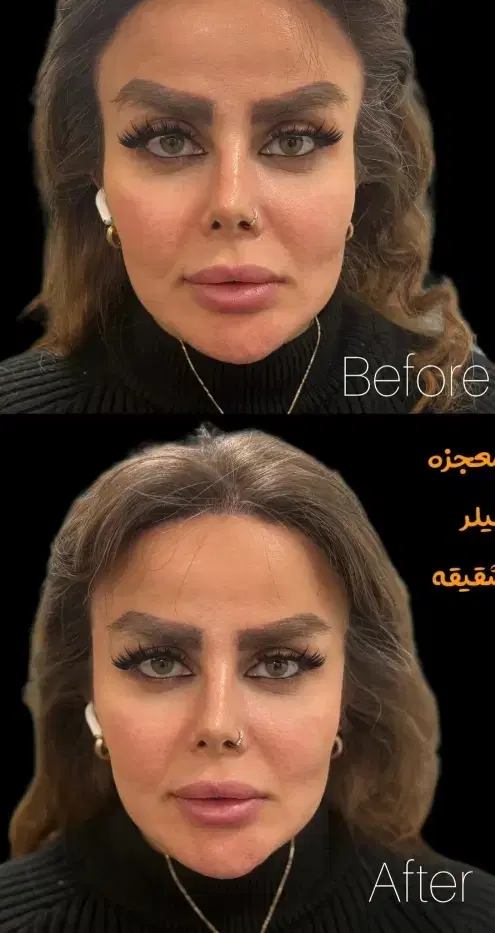 بندانگشتی 9