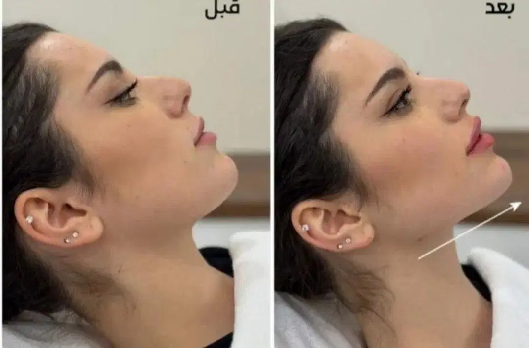 بندانگشتی 3
